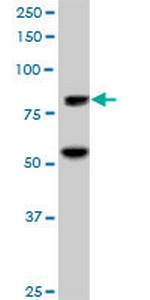 ZNF624 Antibody in Western Blot (WB)