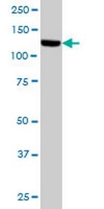 TAOK1 Monoclonal Antibody (4E12)