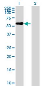 KLHL8 Antibody in Western Blot (WB)