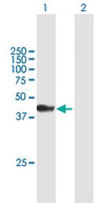 ATPGD1 Polyclonal Antibody, MaxPab™