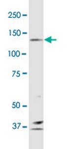 PCDH10 Monoclonal Antibody (4H8)