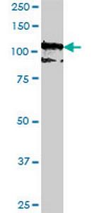PCDH10 Monoclonal Antibody (2H6)