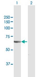 VPS18 Polyclonal Antibody, MaxPab™