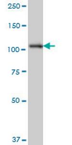 SH3MD2 Monoclonal Antibody (3H3)