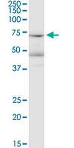LRRN1 Monoclonal Antibody (3D11)