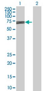 POGK Antibody in Western Blot (WB)