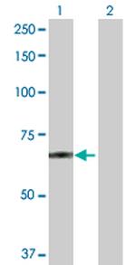 POGK Antibody in Western Blot (WB)