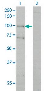 ALS2 Monoclonal Antibody (4F9)