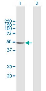 KIAA1576 Polyclonal Antibody, MaxPab™