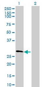 DDX55 Polyclonal Antibody, MaxPab™