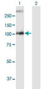 GBA2 Polyclonal Antibody, MaxPab™