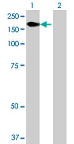 KIAA1618 Antibody in Western Blot (WB)