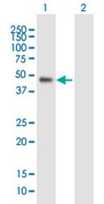 WDR19 Polyclonal Antibody, MaxPab™