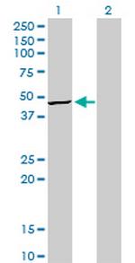 TRIB3 Monoclonal Antibody (1H2)