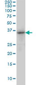 TRIB3 Antibody in Western Blot (WB)