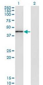 TRIB3 Monoclonal Antibody (3D7)