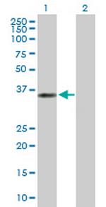 ANKRA2 Antibody in Western Blot (WB)