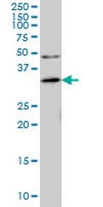 ANKRA2 Monoclonal Antibody (1D11)