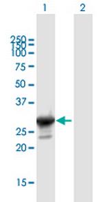GATAD1 Polyclonal Antibody, MaxPab™