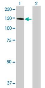 KIAA1967 Antibody in Western Blot (WB)