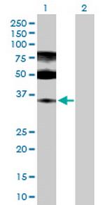 ENOPH1 Polyclonal Antibody, MaxPab™