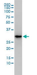 MASA Monoclonal Antibody (3C1-1D5)