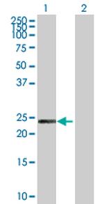 PCTP Polyclonal Antibody, MaxPab™