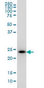 PCTP Monoclonal Antibody (1F9)