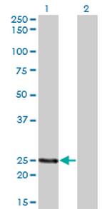 PCTP Antibody in Western Blot (WB)