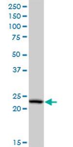 PCTP Antibody in Western Blot (WB)