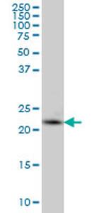 PCTP Antibody in Western Blot (WB)