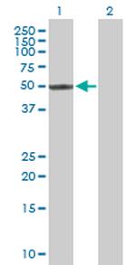 ZNF71 Antibody in Western Blot (WB)