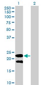 LY6G5B Polyclonal Antibody, MaxPab™