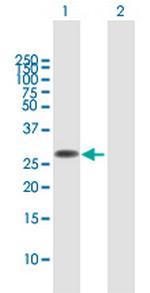 FAM60A Polyclonal Antibody, MaxPab™
