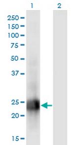 MID1IP1 Monoclonal Antibody (8G8)