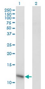 C6orf115 Monoclonal Antibody (1G12-1D7)