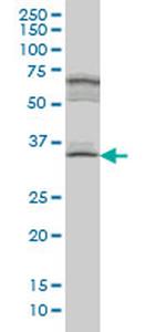 MYOZ1 Antibody in Western Blot (WB)
