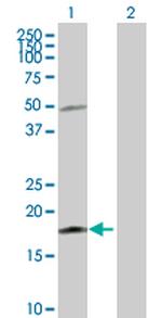 IL21 Polyclonal Antibody, MaxPab™