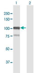 AFAP1 Polyclonal Antibody, MaxPab™