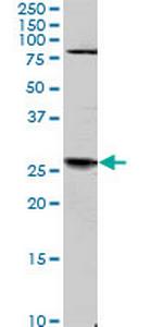 TGIF2 Monoclonal Antibody (4C10)