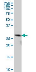TGIF2 Monoclonal Antibody (5G1)