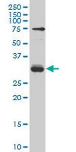TGIF2 Monoclonal Antibody (5G6)