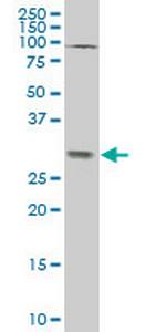 TGIF2 Monoclonal Antibody (6B10)