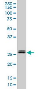 TGIF2 Monoclonal Antibody (2F3)