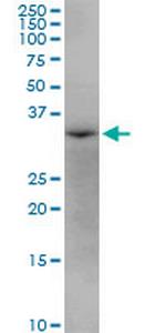 AASDHPPT Polyclonal Antibody, MaxPab™