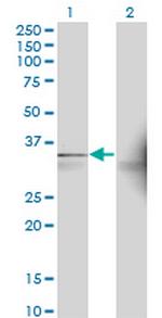 AASDHPPT Monoclonal Antibody (2C12)
