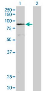 ELAC2 Antibody in Western Blot (WB)