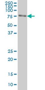 FKBP10 Antibody in Western Blot (WB)