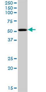 PKNOX2 Polyclonal Antibody, MaxPab™