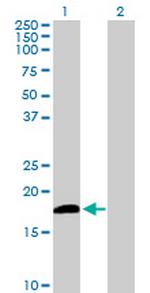 DUSP21 Polyclonal Antibody, MaxPab™